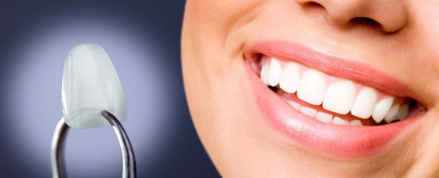 Почему стираются зубы – 3 вредных привычки, о которых стоит забыть